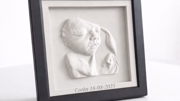 3D/4D Echo Herinnering in Lijst